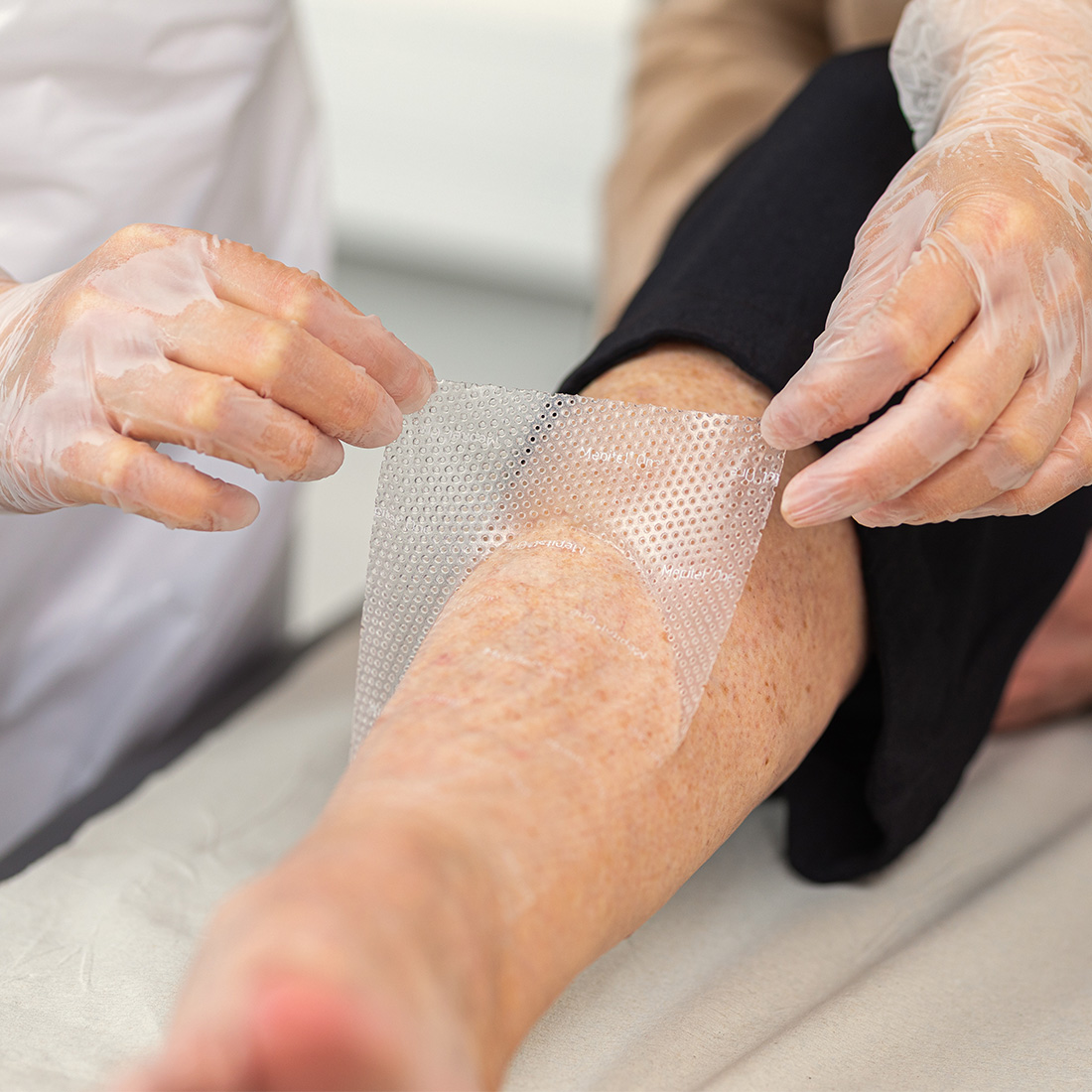 Curativo Camada Contato Malha de Silicone Mepitel One - Imagem 3