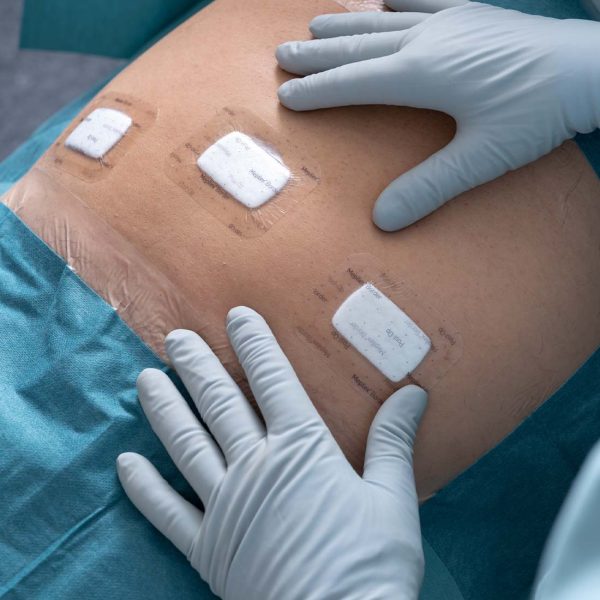 Curativo Pós-operatório Mepilex Border Post-Op - Image 7